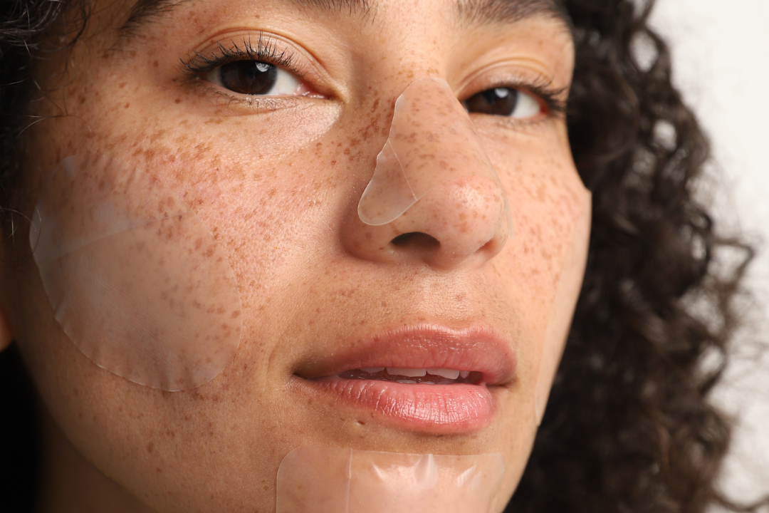 How Long to Leave Pimple Patches on and What to do After Removing