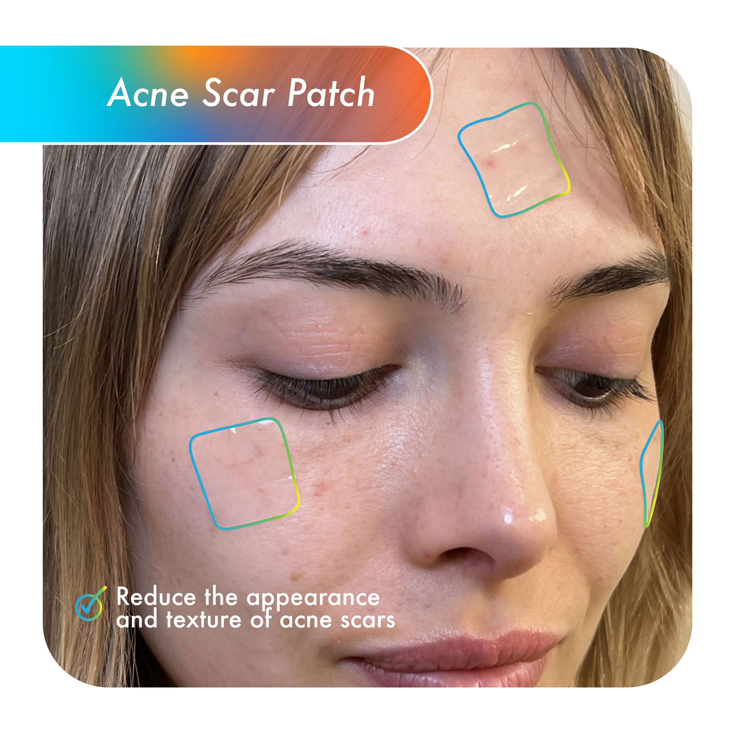 acne scar patch on face