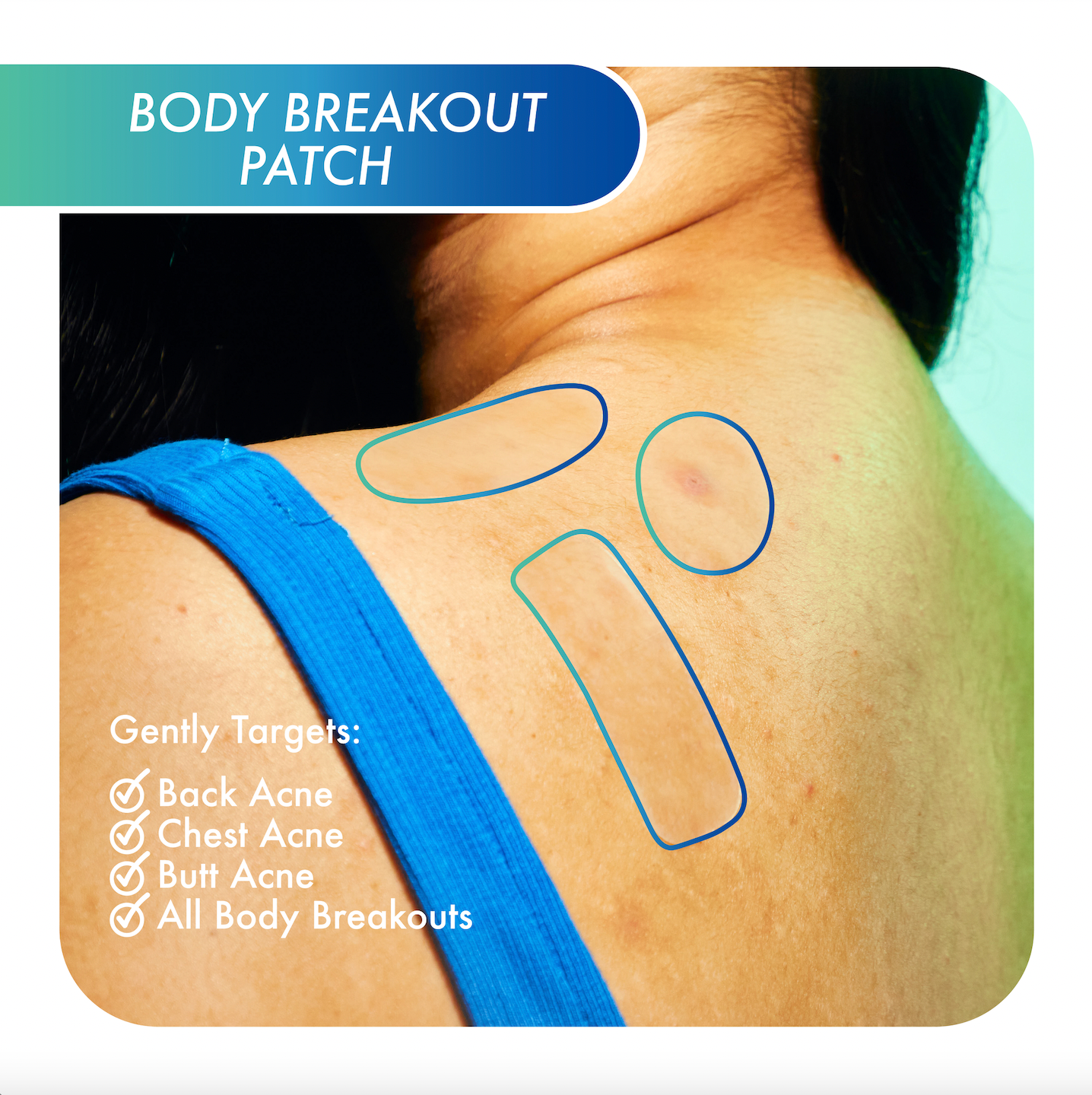 body breakout patch